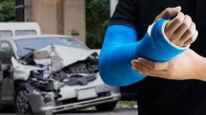 Common Car Accident Injuries: What You Need to Know 